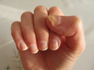 Healthy Natural Nails, grow nails naturally, daily tips for nail care , how to get healthy nails home remedies, how to get healthy nails naturally, grow nails naturally