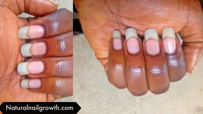 Long Nail Beds And Its Importance To Nail Growth Get Long Nails   Adobe Post 20190219 113835 