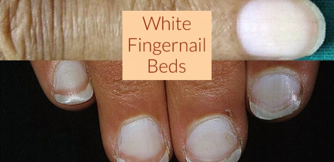 White Fingernail Beds : What It Means - Get Long Nails - Nails Blogger