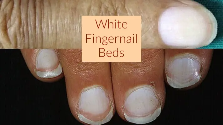 white-fingernail-beds-what-it-means-get-long-nails