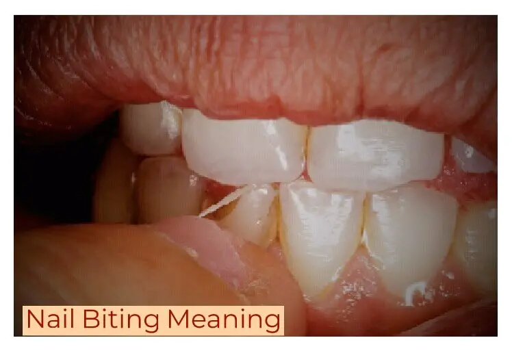 What Does Biting Mean In Slang