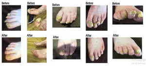 How To Care For Your Feet And Toenails With Pictures