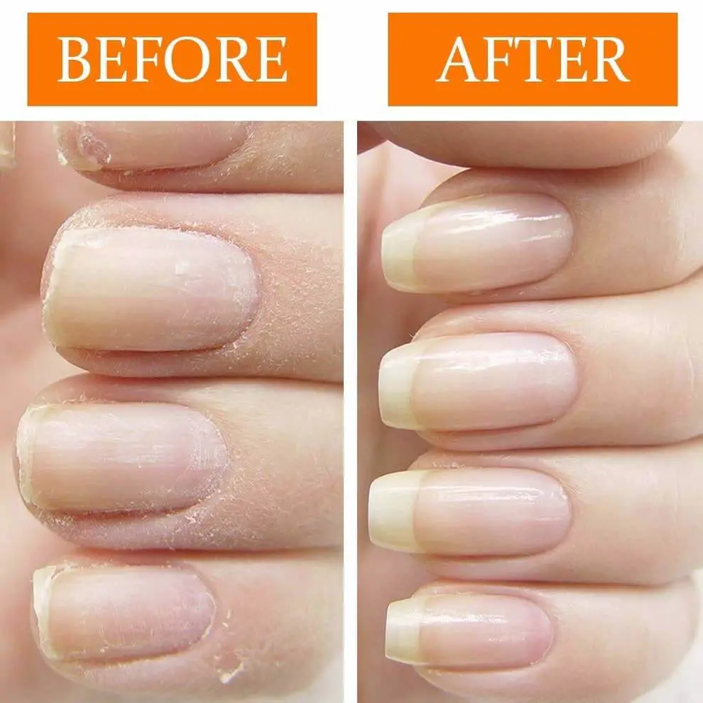 is-jojoba-oil-good-for-nail-growth-get-long-nails