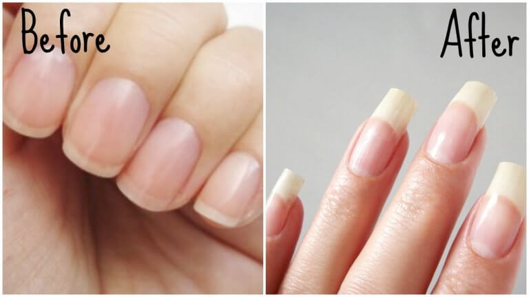 9-factors-affecting-nail-growth-and-possible-solution-get-long-nails