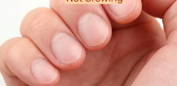 why-are-my-fingernails-not-growing-9-reasons-solution-get-long