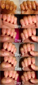 How Long Do Nails Grow In A Week, quanto crescono le unghie in una settimana