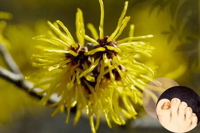 Does Witch Hazel Cure Nail Fungus?