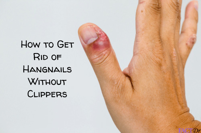 How to Get Rid of Hangnails Without Clippers